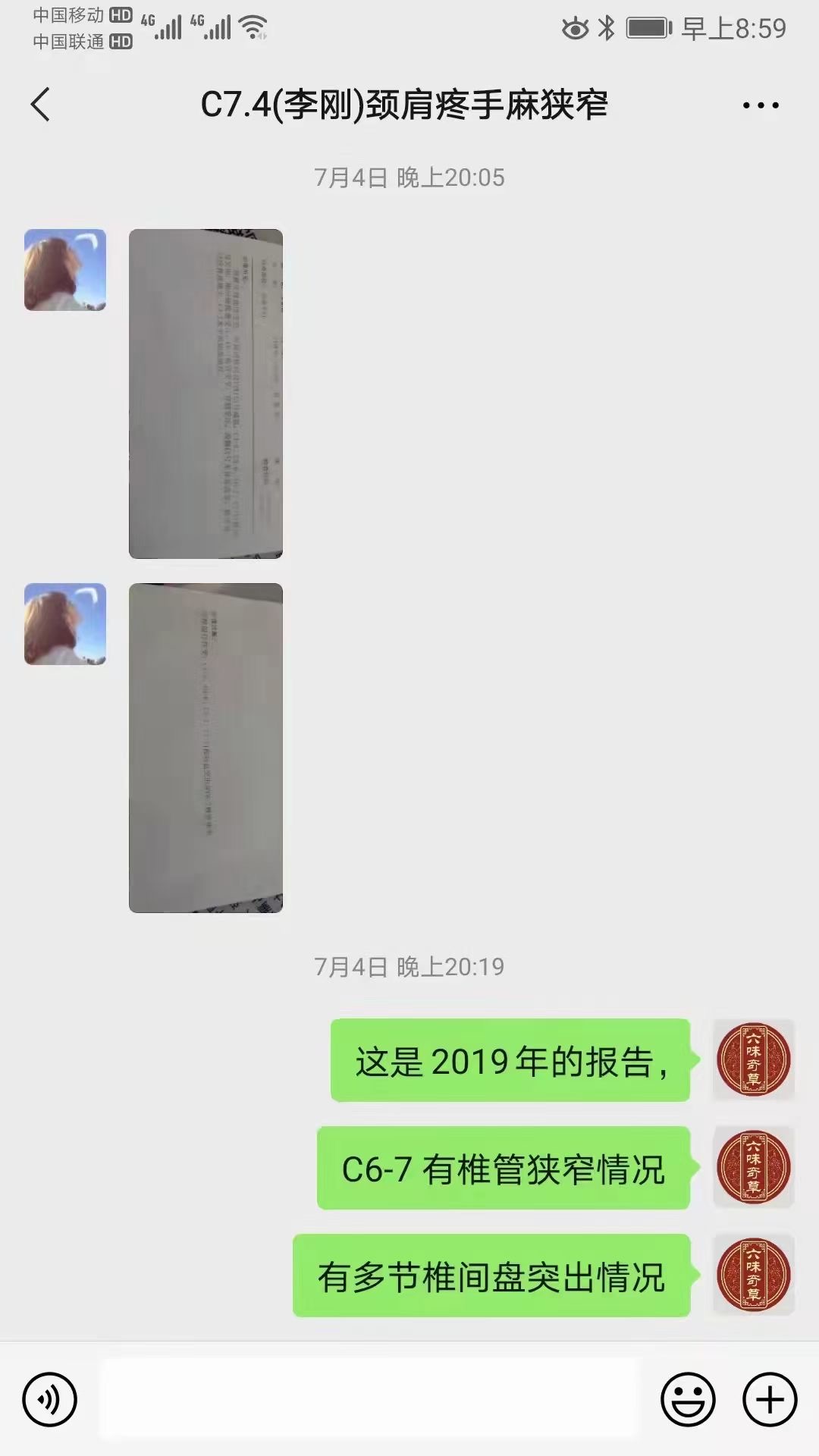 4年的颈椎病  4-7节突出 6-7椎管狭窄 (图3)